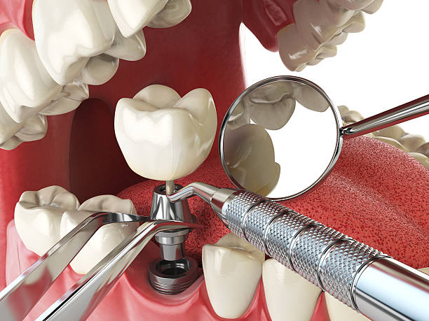 Best Emergency Root Canal Treatment in Whitemarsh Island, GA